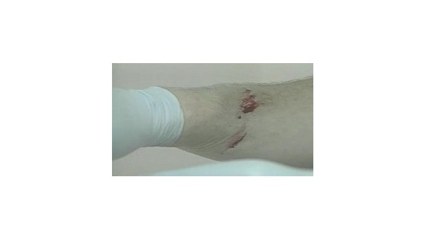 Bloodborne Pathogens: Know The Risk Bloodborne Pathogens: Know The Risk